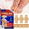 21Pcs Toenail Fungus Patch Waterproof Nail Repair Patches Nail Ingrown Correction Sticker Discolored Damaged Nail Foot Care Tool