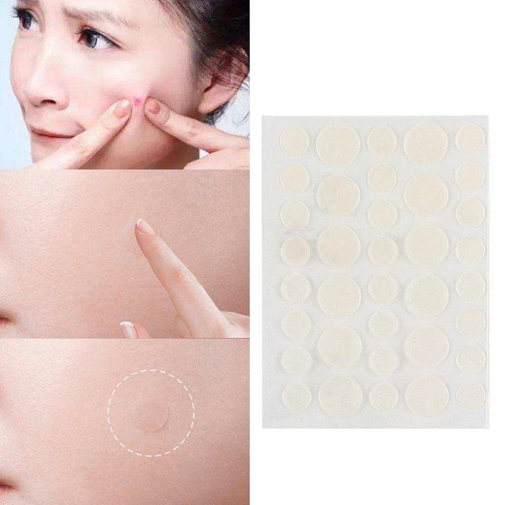 Подушечки для лечения прыщей, пластыри для лечения прыщей на коже лица, доступные гигиенические удобные наклейки-пластыри
