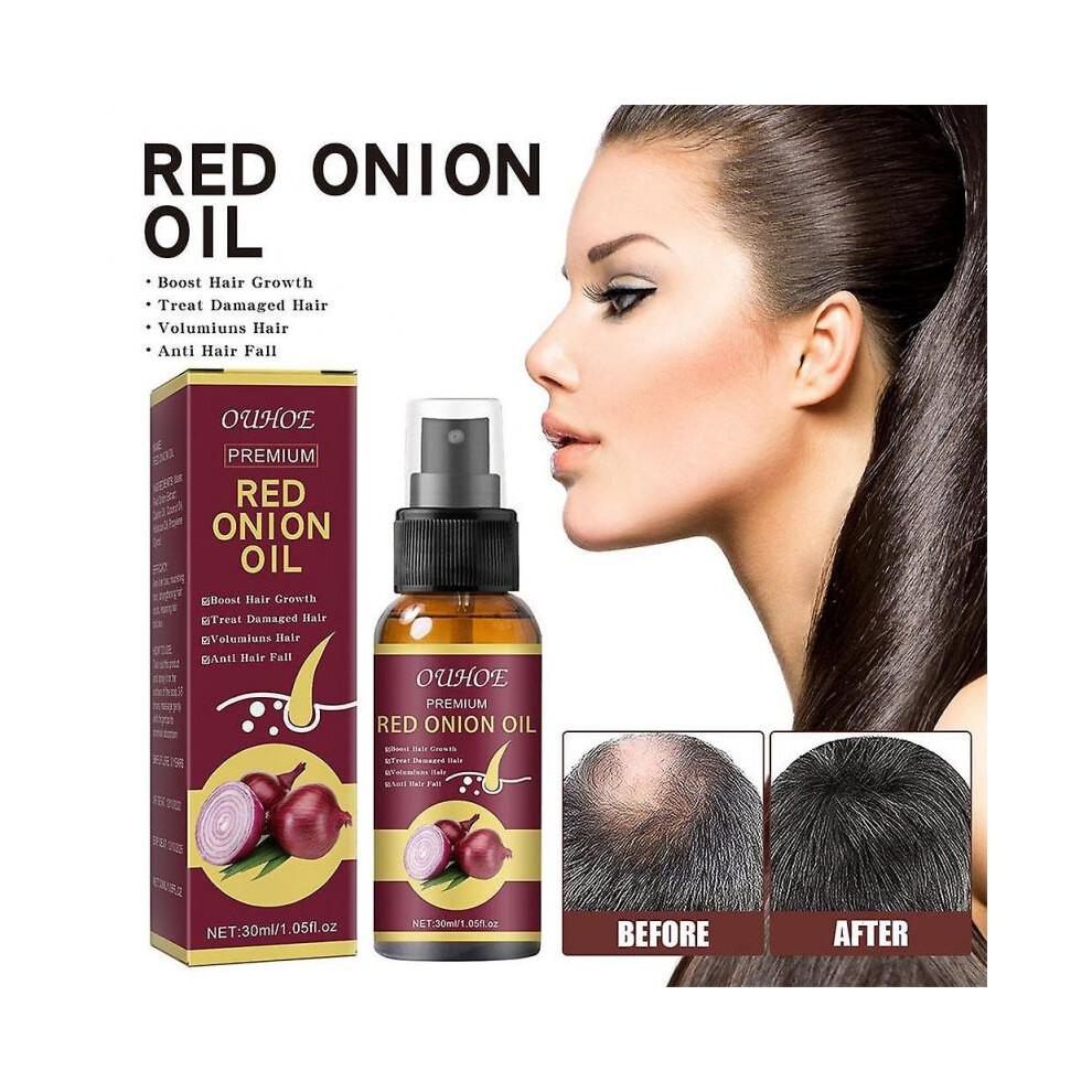Onion Hair Growth Oil 30ml, Anti-Hair Loss Nourishing Essential Oil for Stronger Roots and Healthy Scalp