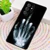 Чехол для телефона из ТПУ с изображением костей руки Рентген для Samsung Galaxy note 10 pro S26 S25 S24 S23 S22 Ultra Plus S21 FE S20 Ударопрочный чехол