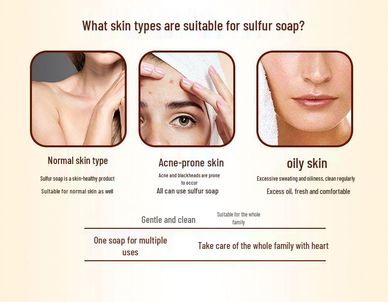 Vitality 28 Sulfur Soap 90g Pack: 10 Bars for Face, Bath, Hands - Deep Clean with Classic Sulfur Formula