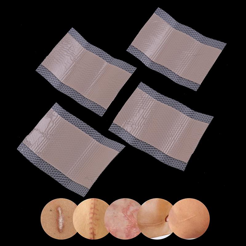 Хирургическое удаление шрамов, наклейка, пластырь, силиконовый гель, эффективное лечение шрамов