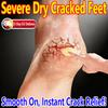 Foot & Hand Cracked Skin Cream - For Dry, Cracked Feet & Hands