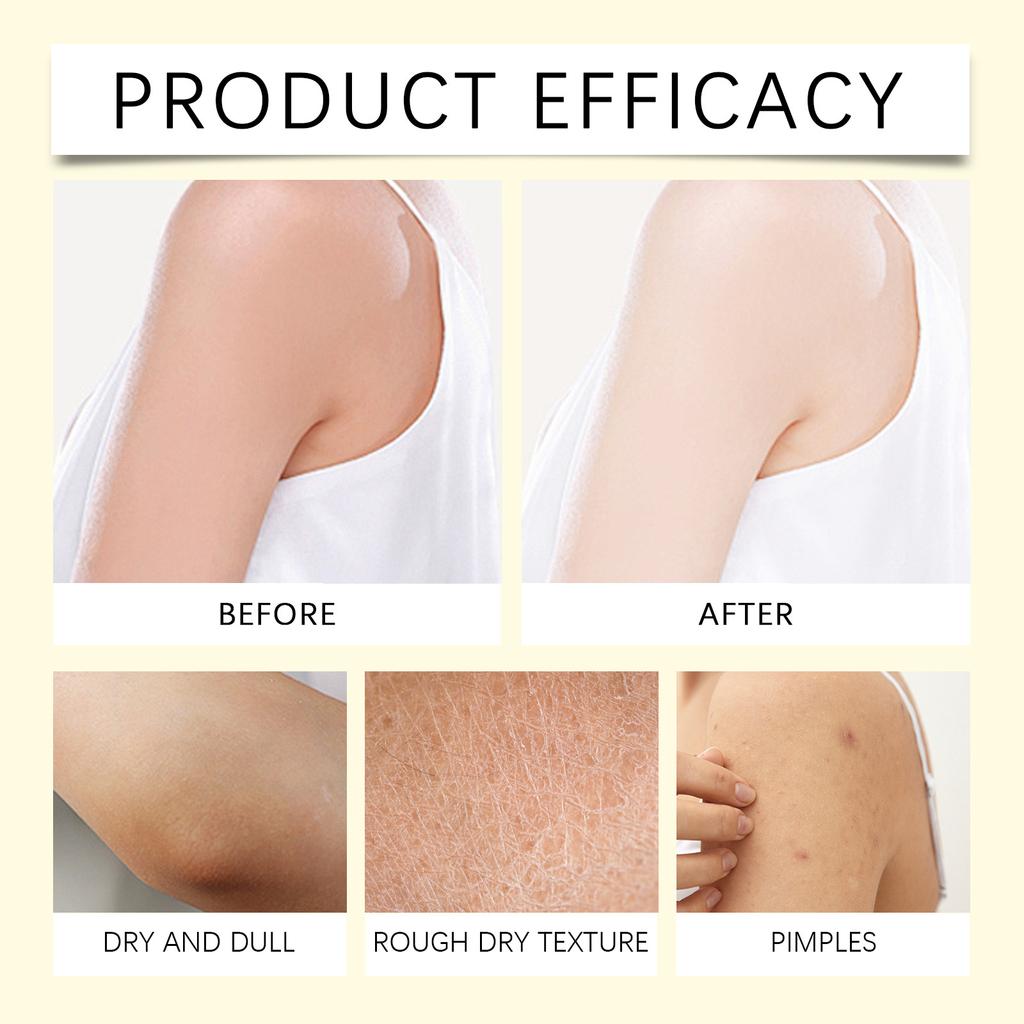 Skin Antioxidant Moisturizer Relieves Dry Skin Nourishes Skin And Restores Skin Elasticity