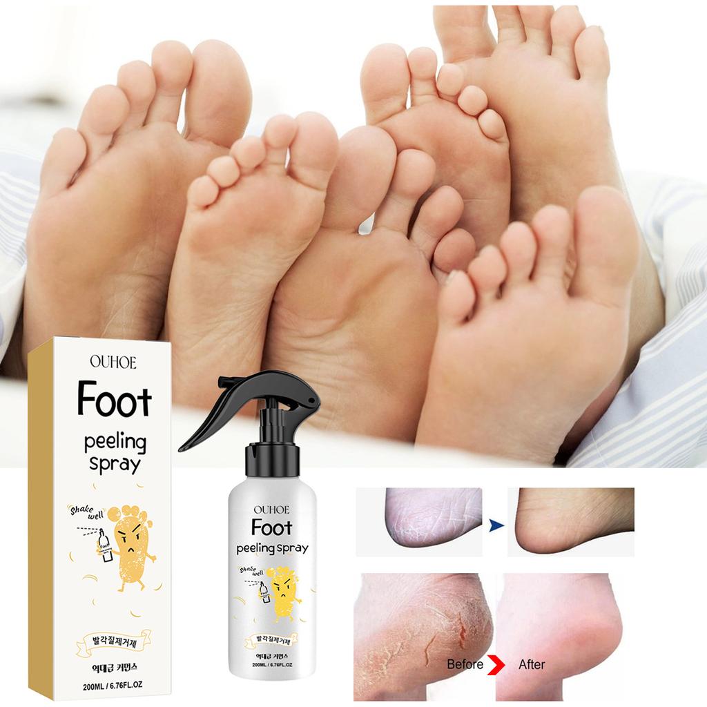 EELHOE Foot Peeling Spray Natural Orange Essence Pedicure Hands Dead Skin Exfoliator Mask Whiten Baby Foot Care Tool