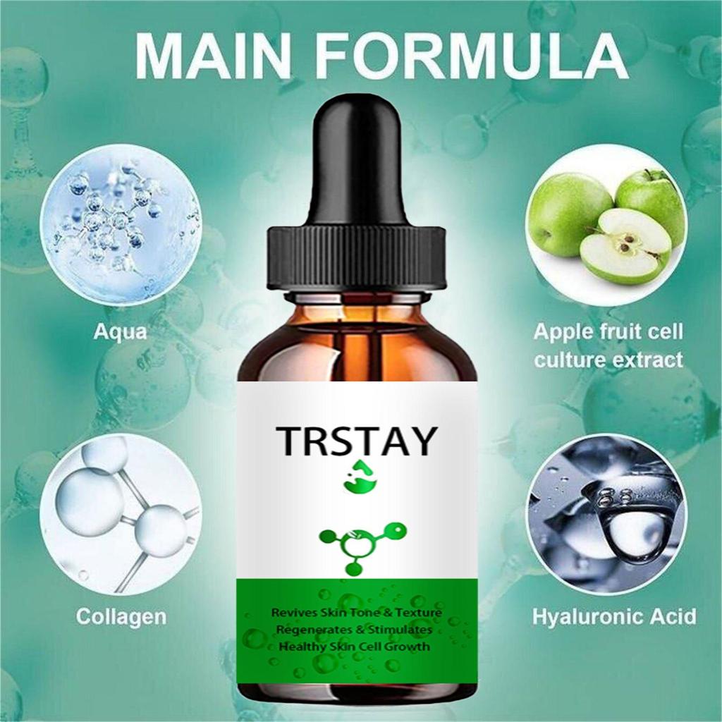 5ML/15ML/30ML/50ML/Anti Redness Solution ,Spider Vein Removal Advanced Treatment Clearer Skin Veins On Face