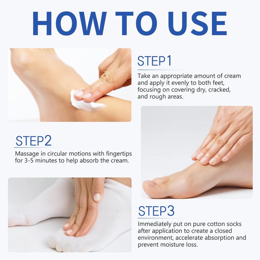 42% Urea Cream-With Alove Vera and Coconut Oil-Deeply Moisturizes Dry Skin On Hands and feet-24-Hour Hydration,50g