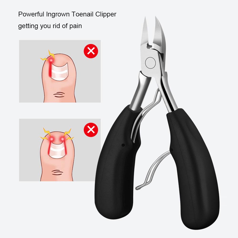 7 шт., набор инструментов для лечения вросших ногтей на ногах, инструменты для педикюра, коррекция удаления вросших ногтей на ногах