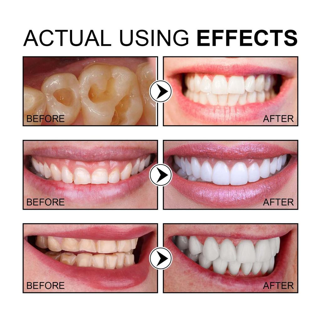 Eelhoe Teeth Cleansing Stains Removes Breath Freshen Teeth Whitening Mousse Oral Hygiene Mousse Foam Portable Travel Toothpaste 150ml