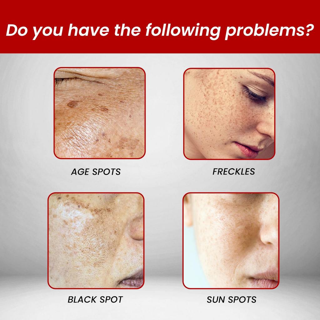 OUHOE Крем для ухода за лицом, осветляет пигментные пятна, увлажняет и питает, восстанавливает кожу, придает сияние и отбеливает. Подходит для использования на лице, 20 г.