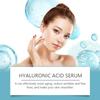 Увлажняющая сыворотка для лица Нежное увлажнение Гидратация Смягчение кожи лица Питательная лечебная эссенция