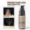 Hair Growth Essence Anti Hair Loss Products Essential Liquid Prevent Hair Loss Hair Care Product