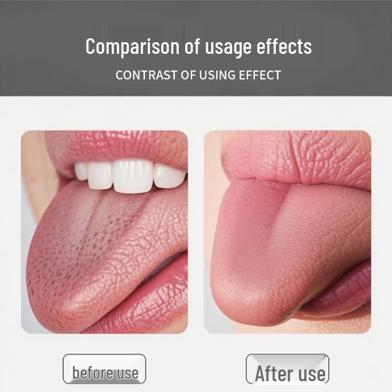 Stainless Steel Tongue Scraper Set - Personal Care Oral Cleaning Tool