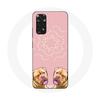 Case - Xiaomi - Redmi Note 11 4G - Dogue De Bordeaux - Symmetrical - Flexible