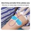 5pcs Fixation Leg Band Holder Urine Catheter Tube Holder Durable Urine Bag Holder  Patient
