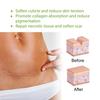 Silicone Scar Sheets Reusable Scar Removal Strips for Post-Surgery Acne Breathable Waterproof Scar Tape