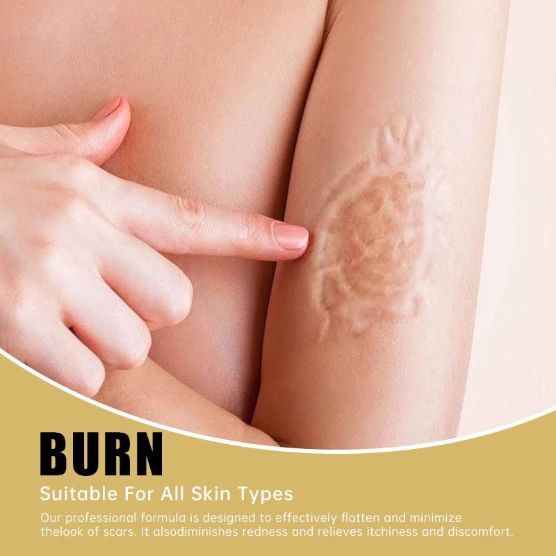 Shea Butter Scar Removal Cream Stretch Marks Treatment Sunburn Burns Old Scars Smoothing Whitening Cream Gel Body Face Skin Care