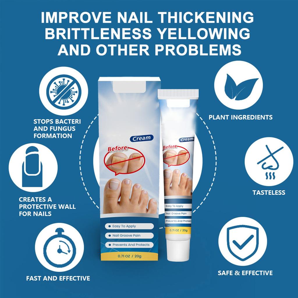 Крем для лечения ногтей, улучшает твердость ногтей, осветляет цвет ногтей