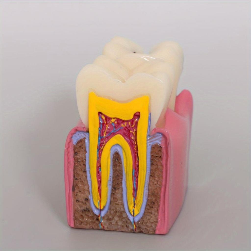 6 раз Модель кариеса зубов Болезнь зубов Стоматологическая модель для демонстрации зубов Модель обучения стоматолога Стоматологическая лаборатория Исследования полости рта