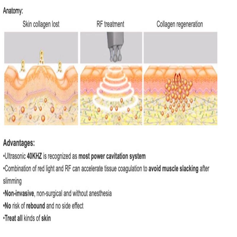 5 In 1 Vacuum Ultrasonic Cavitation Radio Frequency Multipolar RF Body Slimming Machine Skin Lifting Tighten Anti-Wrinkle Device