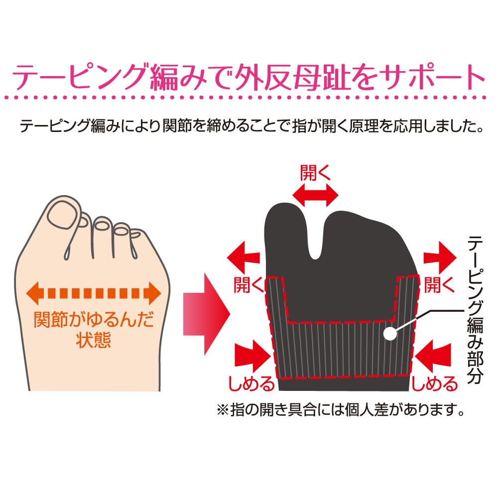 Носки для поддержки косточки большого пальца ноги Alphax Размеры Сделано в Японии (1 пара), Черный, 22.0-25.0см,