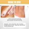 EELHOE Foot Peeling Spray Natural Orange Essence Pedicure Hands Dead Skin Exfoliator Mask Whiten Baby Foot Care Tool