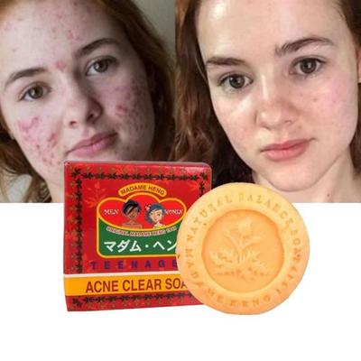 Мыло - Мадам Хенг - Специальное от акне - 150г - Для мужчин и женщин - Контроль акне