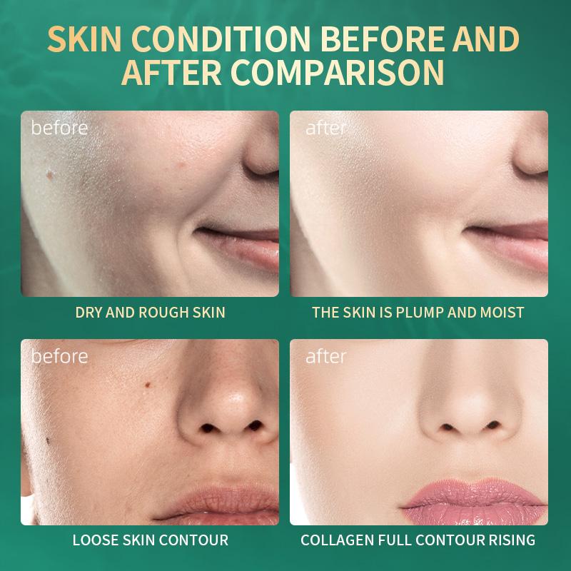 MERCILEN Sea Grape Collagen Firming Revitalizing Cream 30g Anti-Wrinkle Lightening Moisturizing Cream