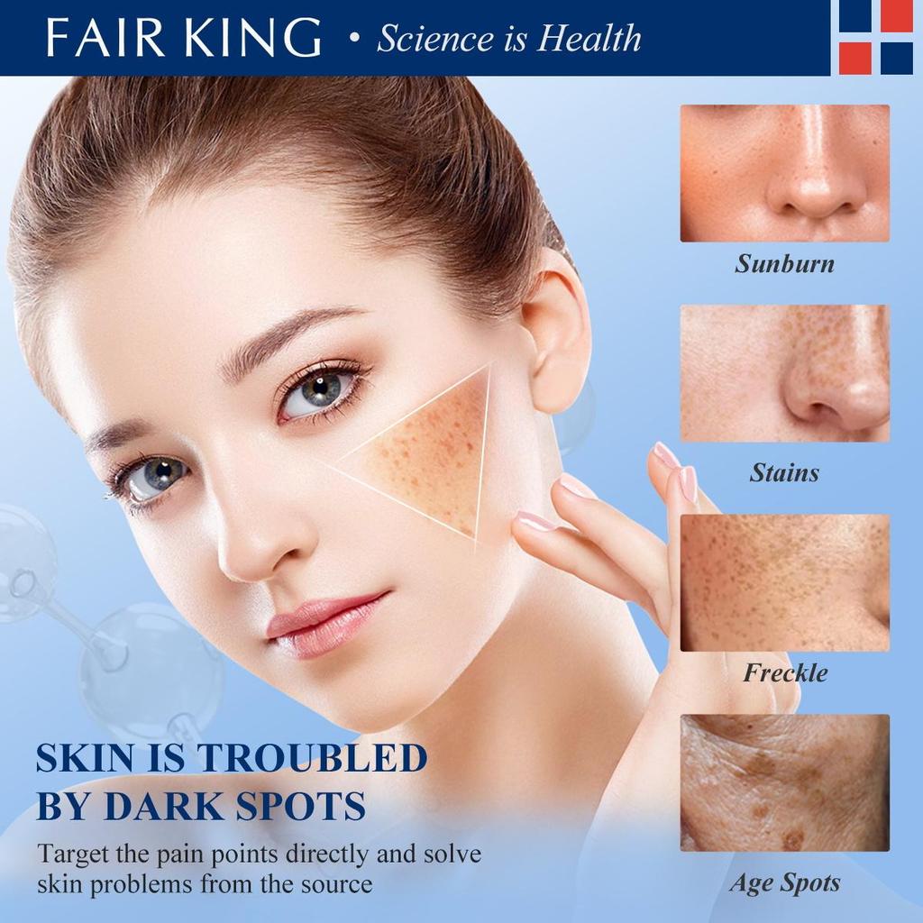 FAIRKING Dark Spot Corrector - Whitening & Blemish Removal 20g