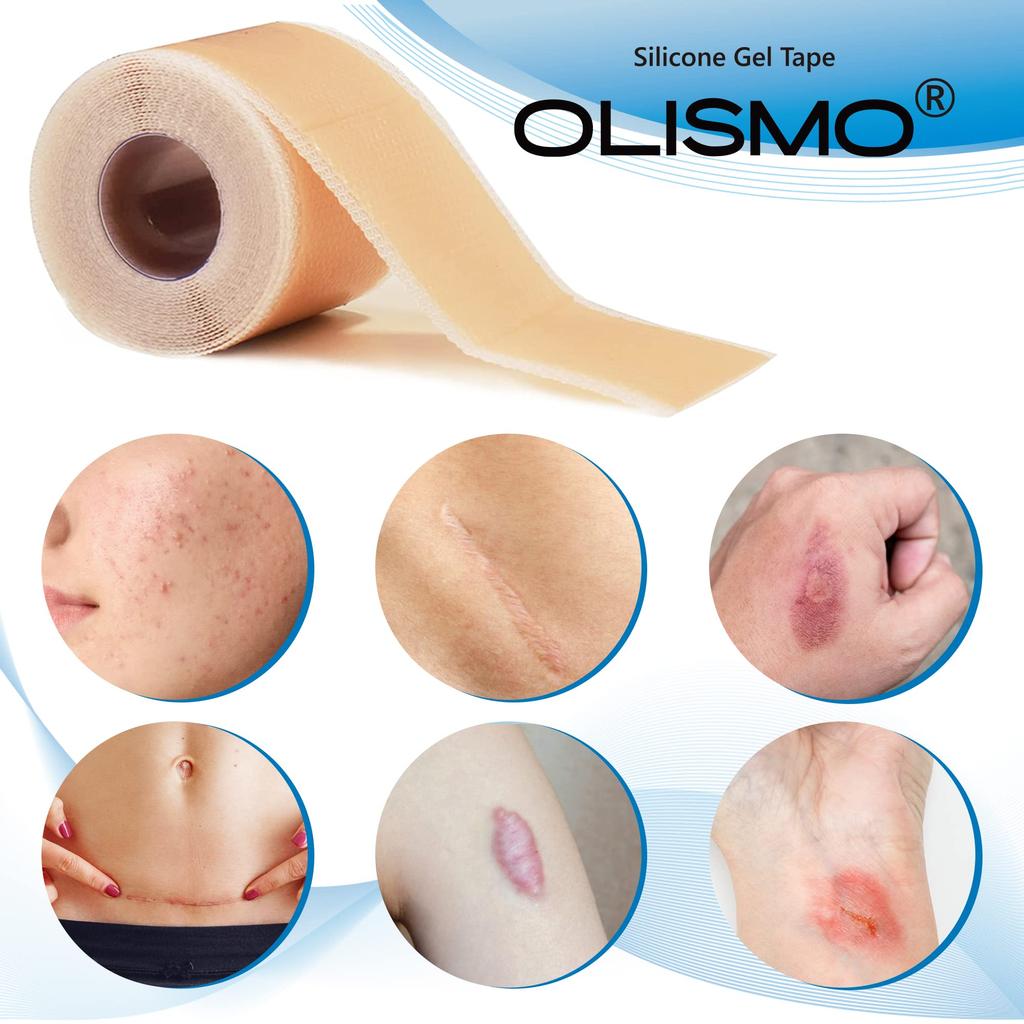 Keloid Tape Silicone Gel Sheet for Scar Care Scar Care Tape 40mm x 3000mm Post-surgery (3m)
