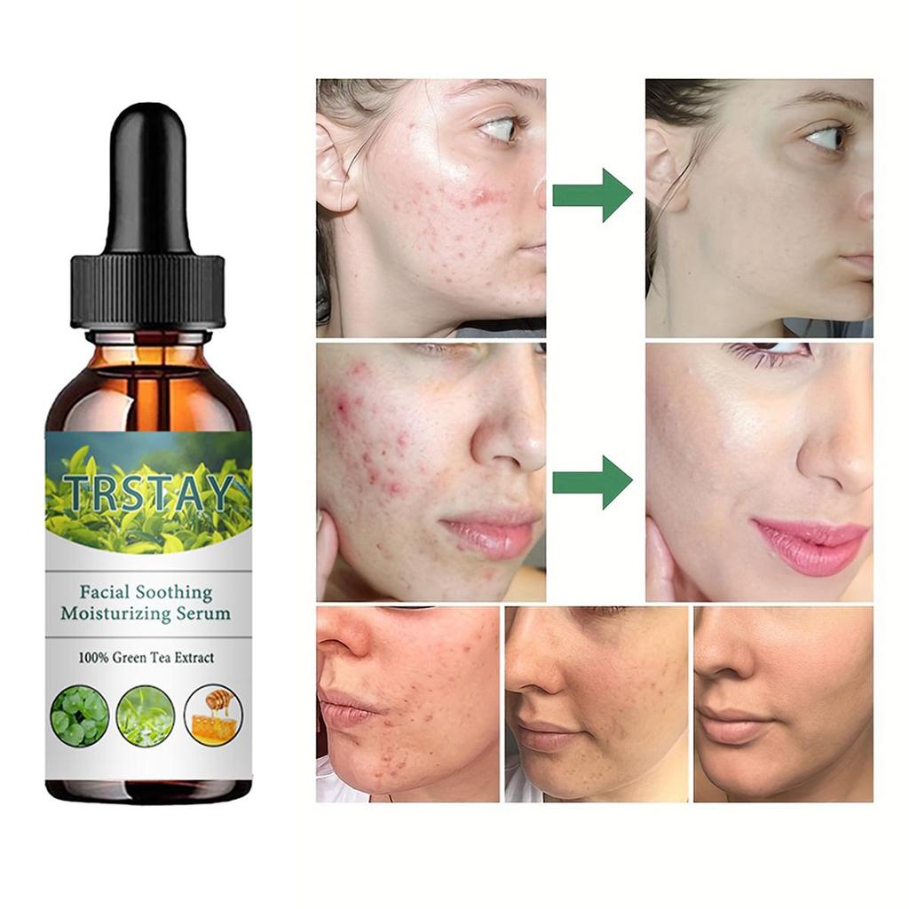 Увлажняющий крем для лица против морщин и тонких линий, укрепляющий крем для глаз