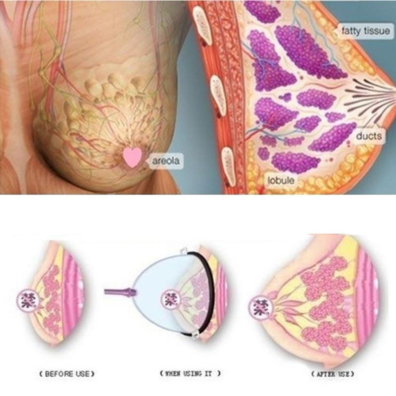 Медицинский портативный твист-насос, вакуумные присоски для сосков, массажный инструмент для банок