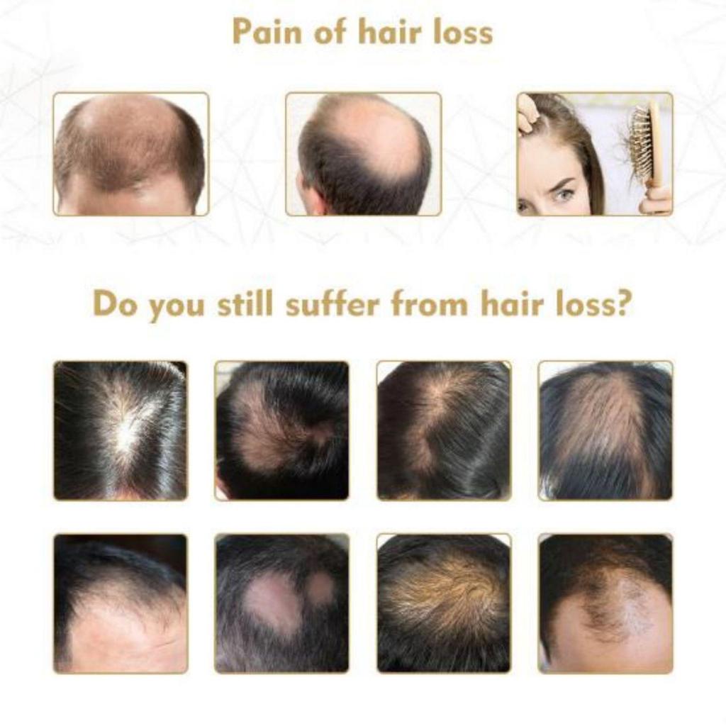 Nourishing, Softening and Anti Hair Loss Care Liquid, Moisturizing and Hair Growth Essence