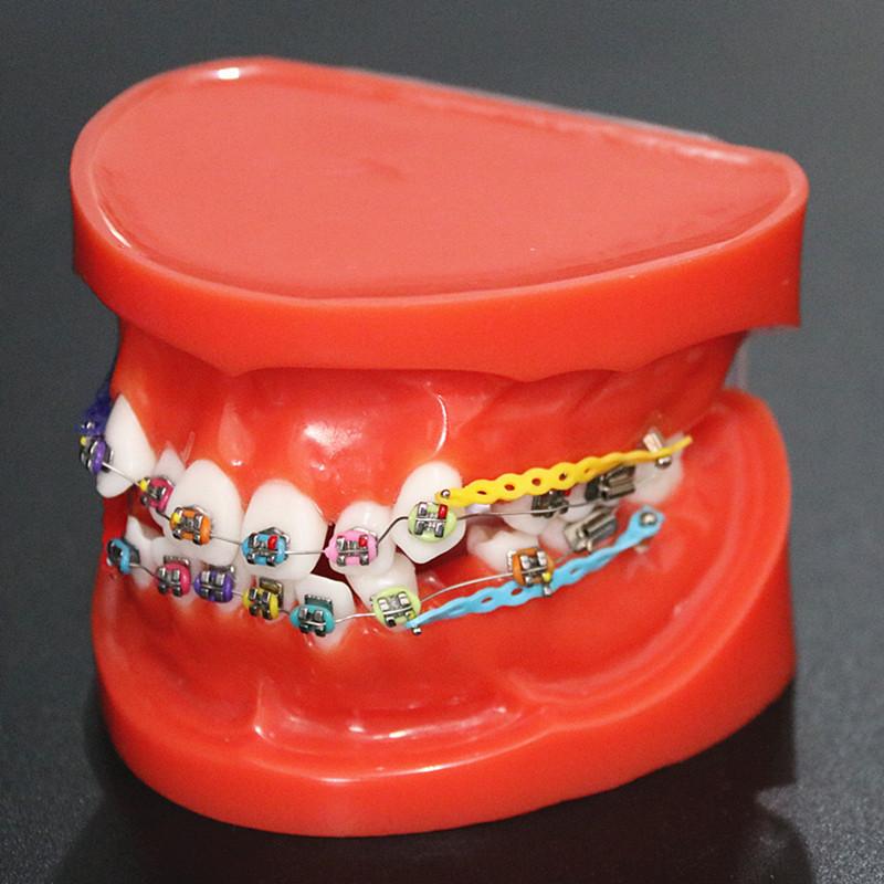 1 шт., прозрачная стоматологическая ортодонтическая модель прикуса с брекетами, буккальная трубка дуги для общения с пациентом