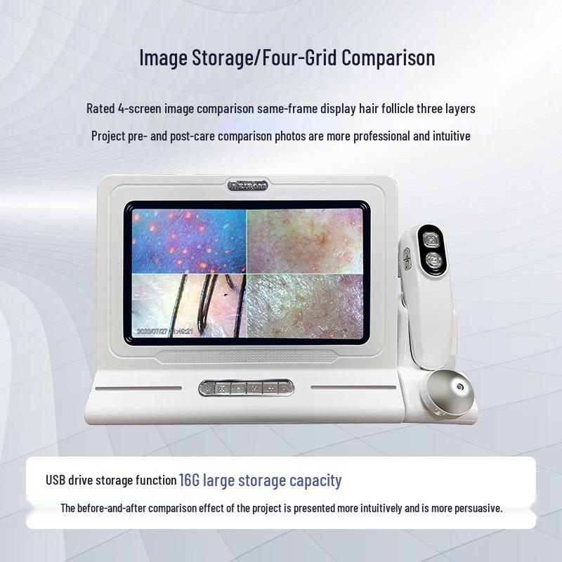 Трехспектральный HD детектор кожи головы и кожи с двумя объективами и сравнением в четырех сетках для парикмахерских