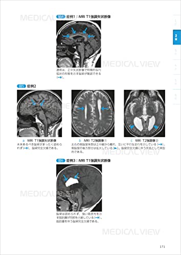 Learning from the Mechanisms of the Human Body: Diagnostic Imaging Technology