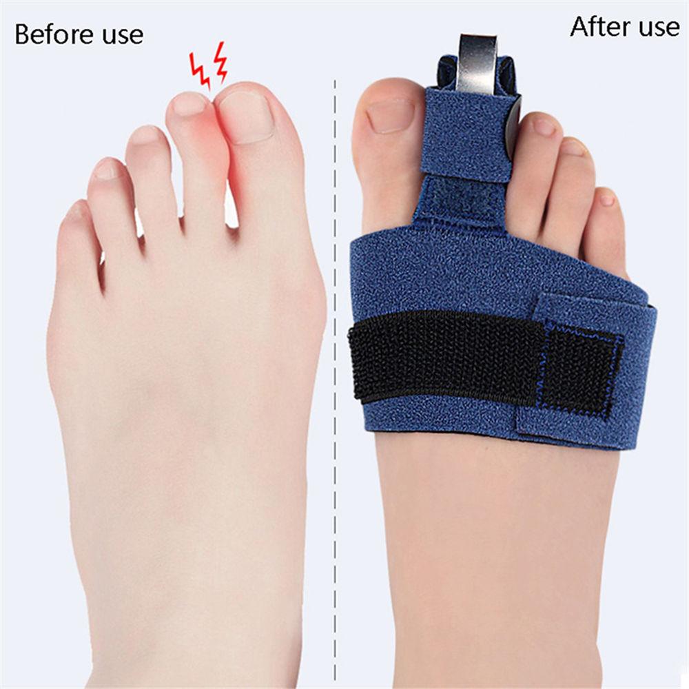 1Pcs Toe Straightener Toe Splint Corrector Toe Wrap For Hammer Toe Bent Claw And Crooked Toe To Align Support Toes Foot Care Tool
