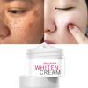 Skin Whitening Whitening Cream Spotted Freckle Fade Cream