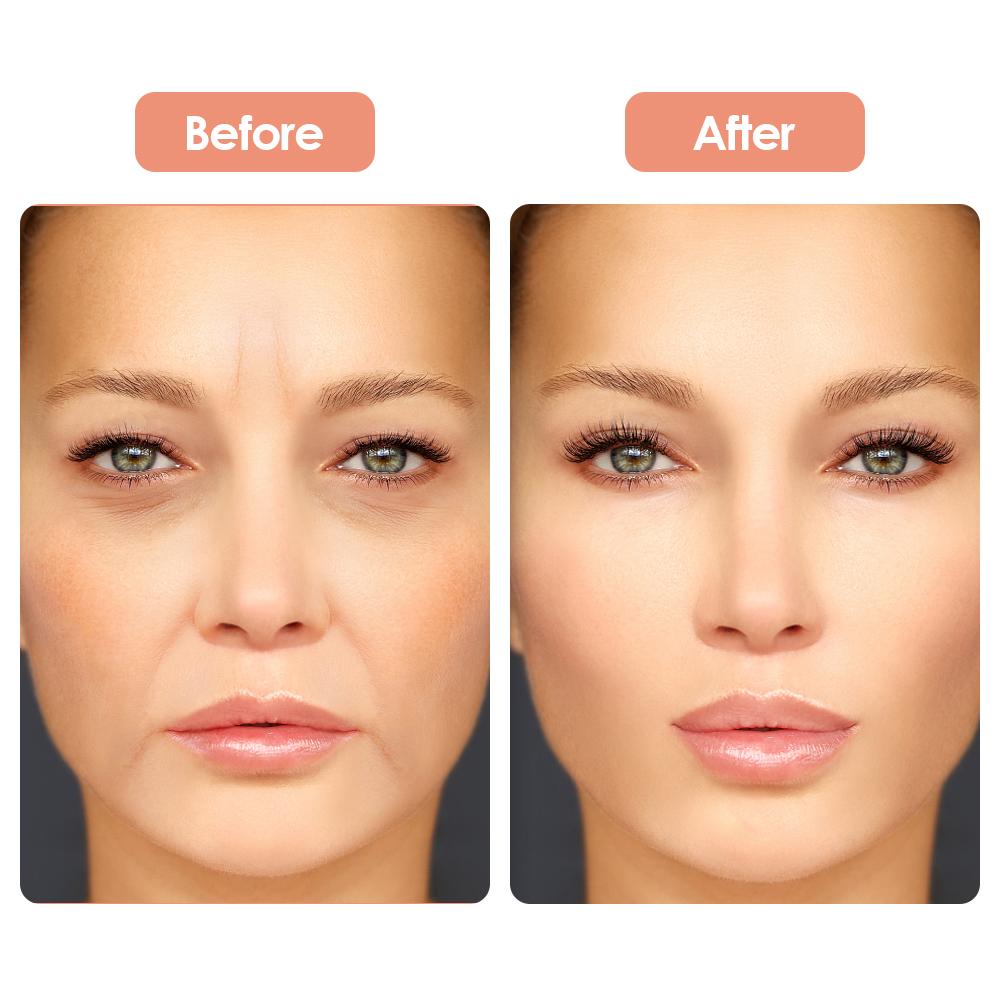 Силиконовые наклейки для удаления морщин 5 шт. многоразовые подушечки для лица и лба патчи для глаз лифтинг уход за кожей антивозрастные косметические средства