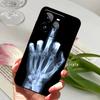 Чехол для Realme GT 7 Pro GT7 Pro Милый Животный Ударопрочный ТПУ Силиконовый Чехол для Телефона Для OPPO REALME GT 7Pro Бампер RMX5010 Fundas