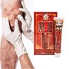Natural Extract Varicose Vein Relief Vasculitis Phlebitis Spider and Improved Circulation