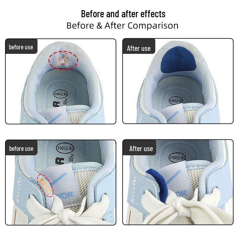 Заплатка для ремонта кроссовок и обуви: Устранение боковых повреждений, дыр в подкладке и износа пятки