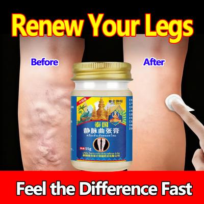 Крем от варикоза с конским каштаном - Облегчение для тяжелых ног, отечности, улучшает кровоток, травяная мазь 55 г