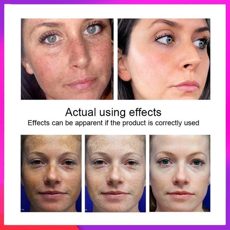 Новейший отбеливающий крем для лица с витамином С, ремонт, выцветание веснушек, удаление темных пятен, средство для удаления меланина, осветляющий крем для лица