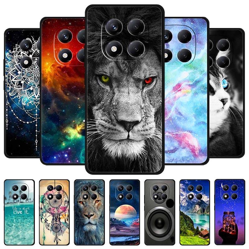 For Xiaomi Redmi Note 15 Pro / Note 15 Pro+ 5G Case Global Version 25060RABDG 2510ERA8BG Luxury Soft Silicone Back Cover Cases