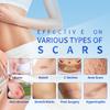 Невидимый пластырь для шрамов Прозрачный пластырь для шрамов Пластырь для удаления и заживления шрамов  (40мм х 1,5м)