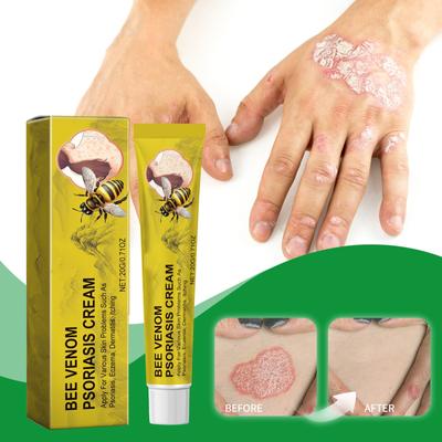 Мазь для ухода за кожей тела, пчелиный яд, паста против зуда, мазь для тела, увлажняющий крем, мазь от десквамации сухих чувствительных рук