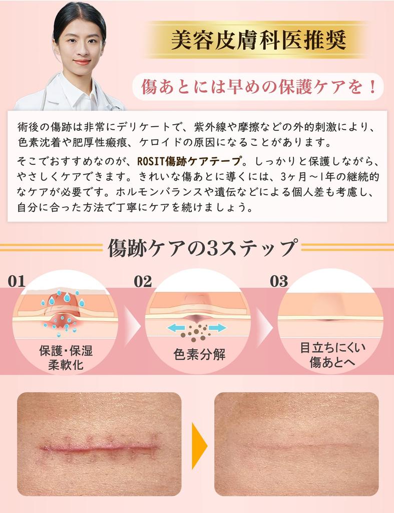 Лента для ухода за шрамами после кесарева сечения, келоидных шрамов, гипоаллергенная и нежная для кожи, для шрамов, силиконовая, настраиваемая, рекомендована дерматологами,