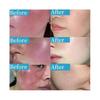 Repair Facial Redness Serum Instant Spider Vein Remove Sensitive Skin Sooth Anti Redness Rosacea Treat Lotion Korean Cosmetics