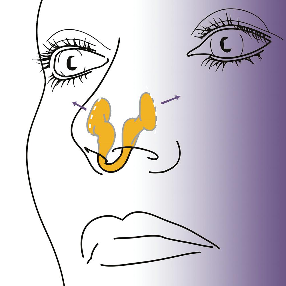 Anti-Snoring Corrector Snore Prevention Gadget Women's Silicone Anti-Snore Device Snore Elimination Elastic Nose Clips